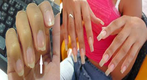 minhas unhas cresceram descontroladamente