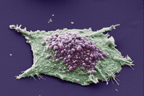 artemisia ataca y elimina células cancerígenas