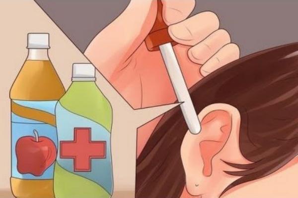 Como aplicar remedio casero para el oído 
